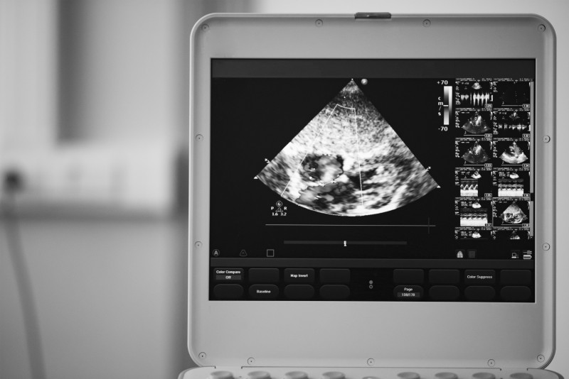 Things to Consider When Looking for Professional Ultrasound Repair Services